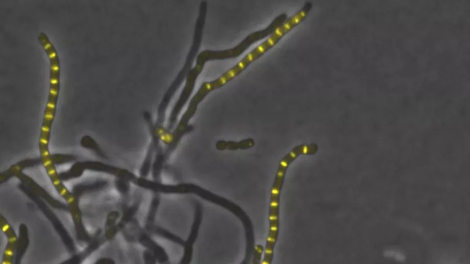 De gula ringarna visar var bakterien Streptomyces venezuelae kommer att dela sig. Bilden består av två foton tagna med fluorescensmikroskop. Skalstrecket är fem tusendels millimeter. Foto: Sebastian Wasserstrom och Yusak Budi Susilo
