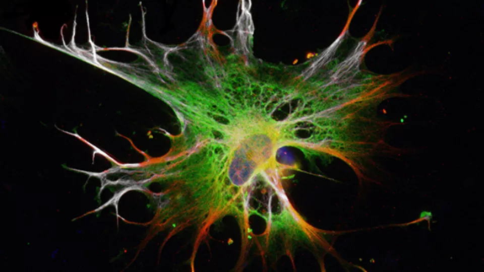 På bilden syns astrocyter som odlats fram från embryonala stamceller. Dessa liknar mycket väl de astrocyter som finns i hjärnan hos vuxna människor, både vad gäller utseende, genetiska profil och i funktion. Bild: Isaac Canals