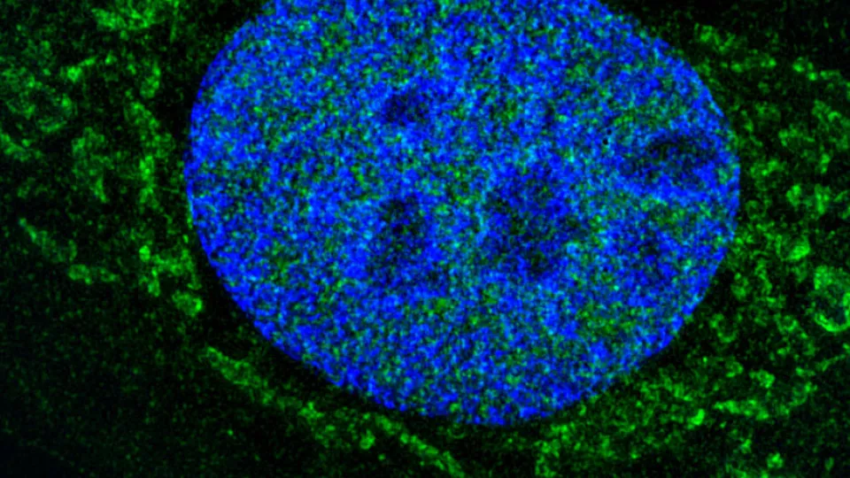 Bild på mitokondrieskelettet i en tumörcell. Cellen har odlats fram från en cellinje av osteosarkom, en cancersjukdom som oftast drabbar barn och unga. Det gröna är det nyupptäckta cellskelettet, det blå är cellens arvsmassa.