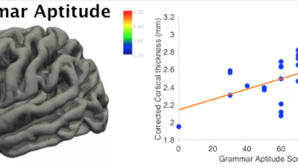 Den färgade fläcken på hjärnan till vänster visar den del av Brocas område där hjärnbarkens tjocklek korrelerade med förmåga att lära sig grammatik. Till höger syns korrelationen mellan grammatisk begåvning och hjärnbarkstjocklek. Bild Mikael Novén
